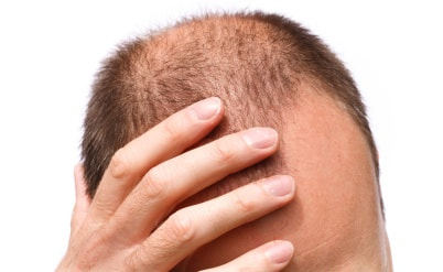 אושרה ייצוגית נגד פרופסיה בשל העלמת מידע