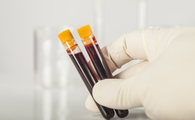 פוטר בשל היותו נשא HIV ויפוצה בכ- 50,000 שקלים